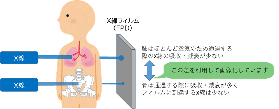 レントゲン撮影の図