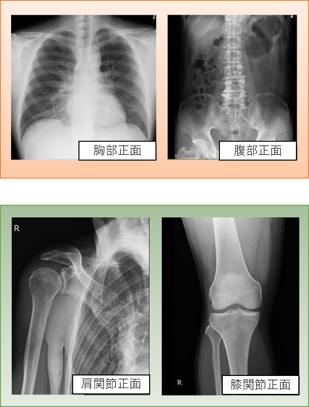 一般撮影の画像例1